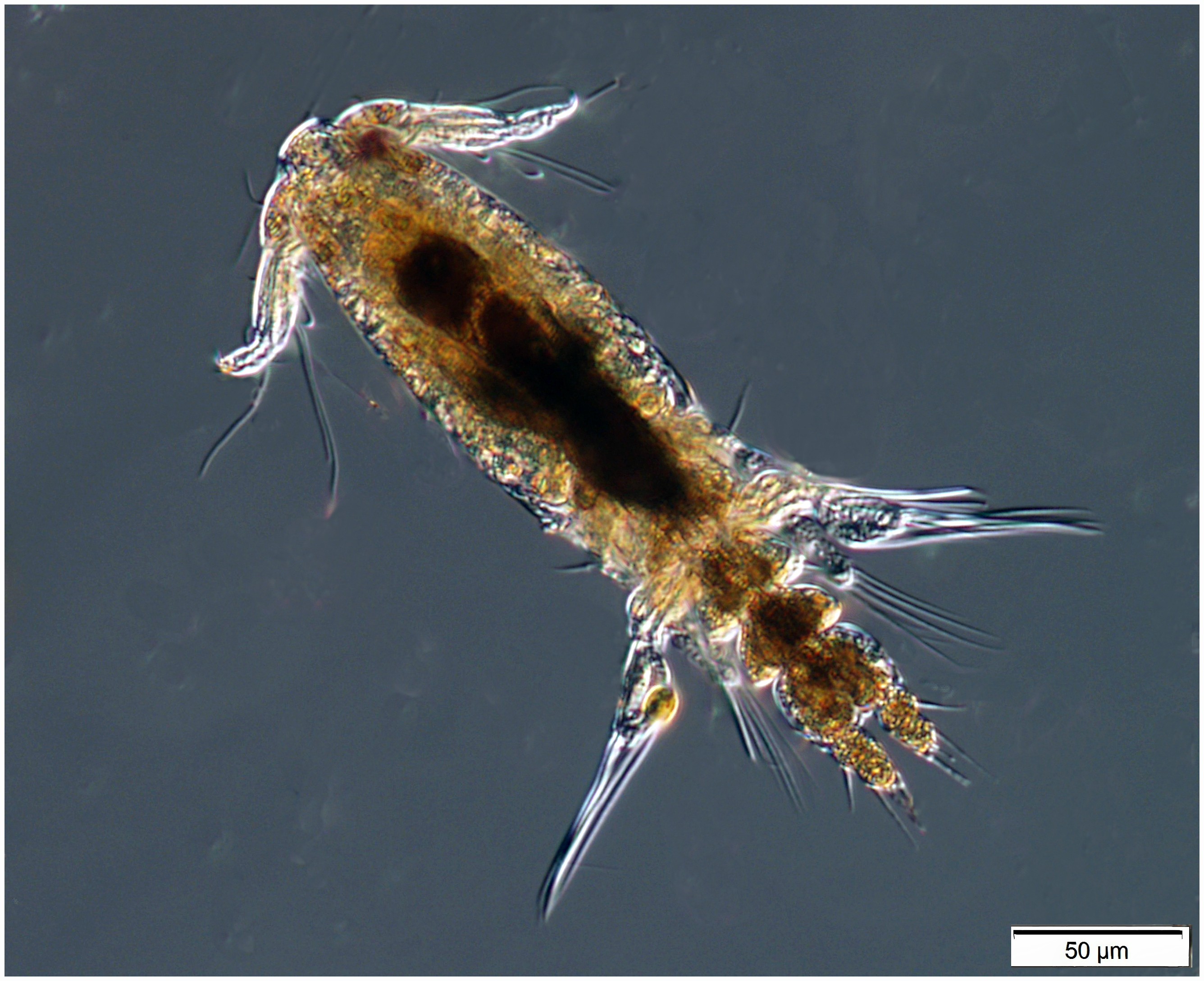 Copepod from Sample 2