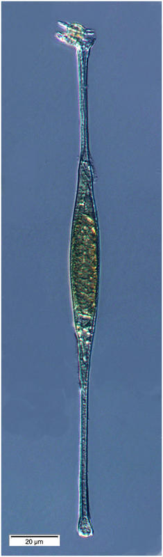 Amphisolenia globifera