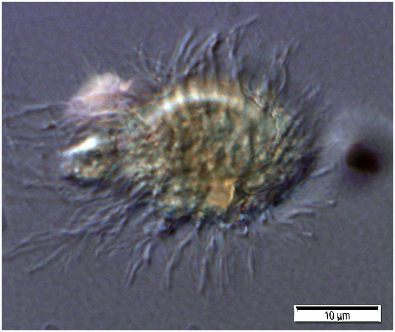 A small predatory ciliate