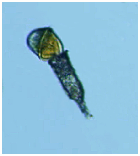 Dinoflagellate attacking a tintinnid