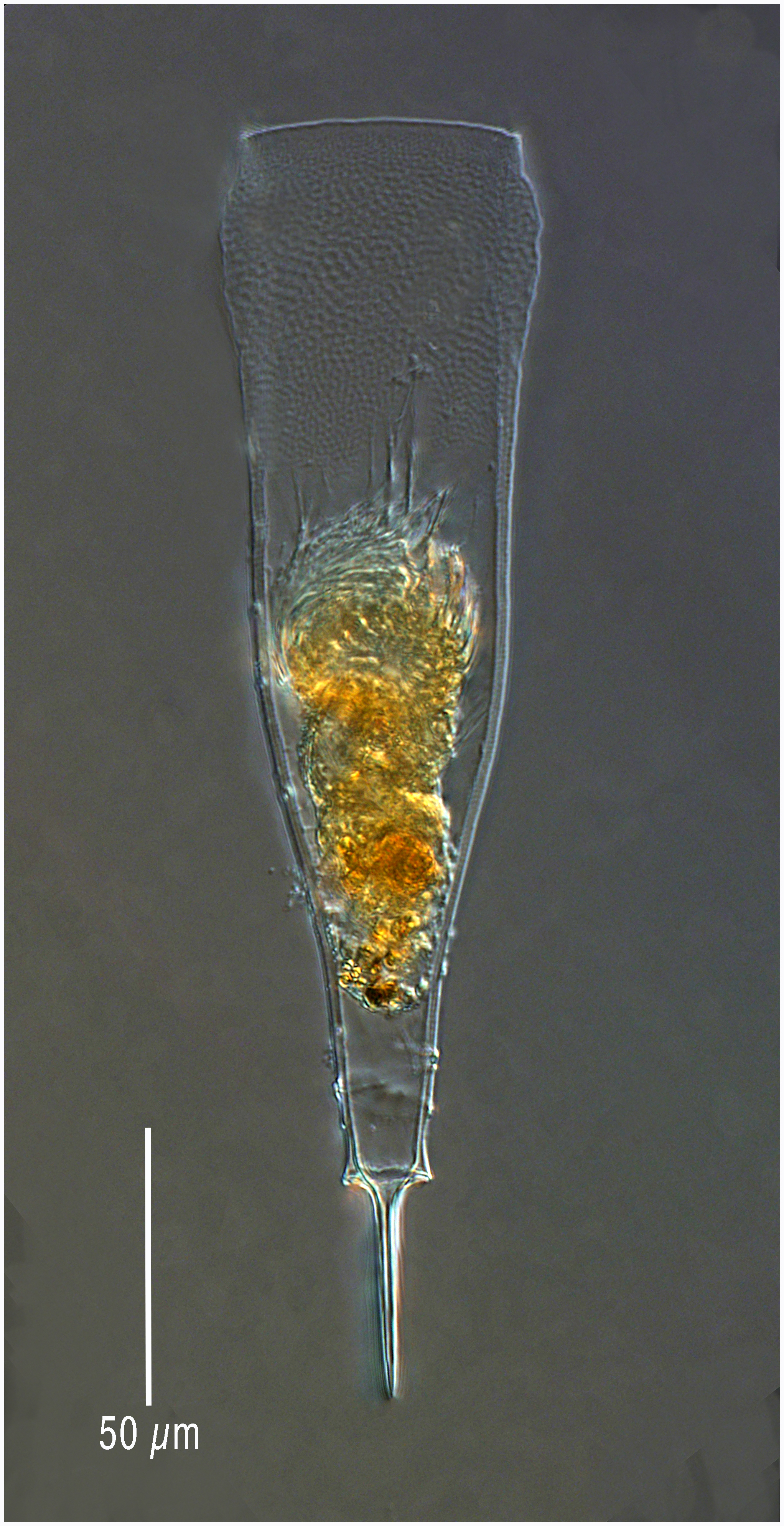 From 2 Km depth - Xystonellopsis spicata