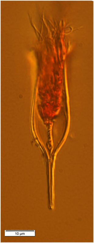 Albatrossiella agassizi