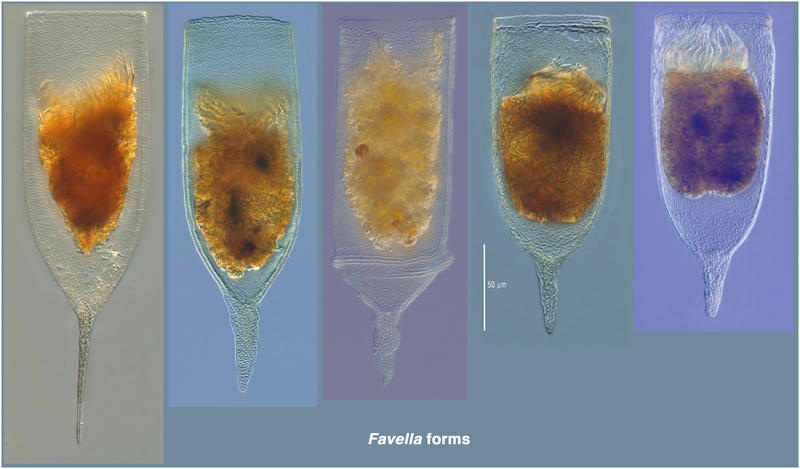 Forms of Favella ehrenbergii from the Etang de THau