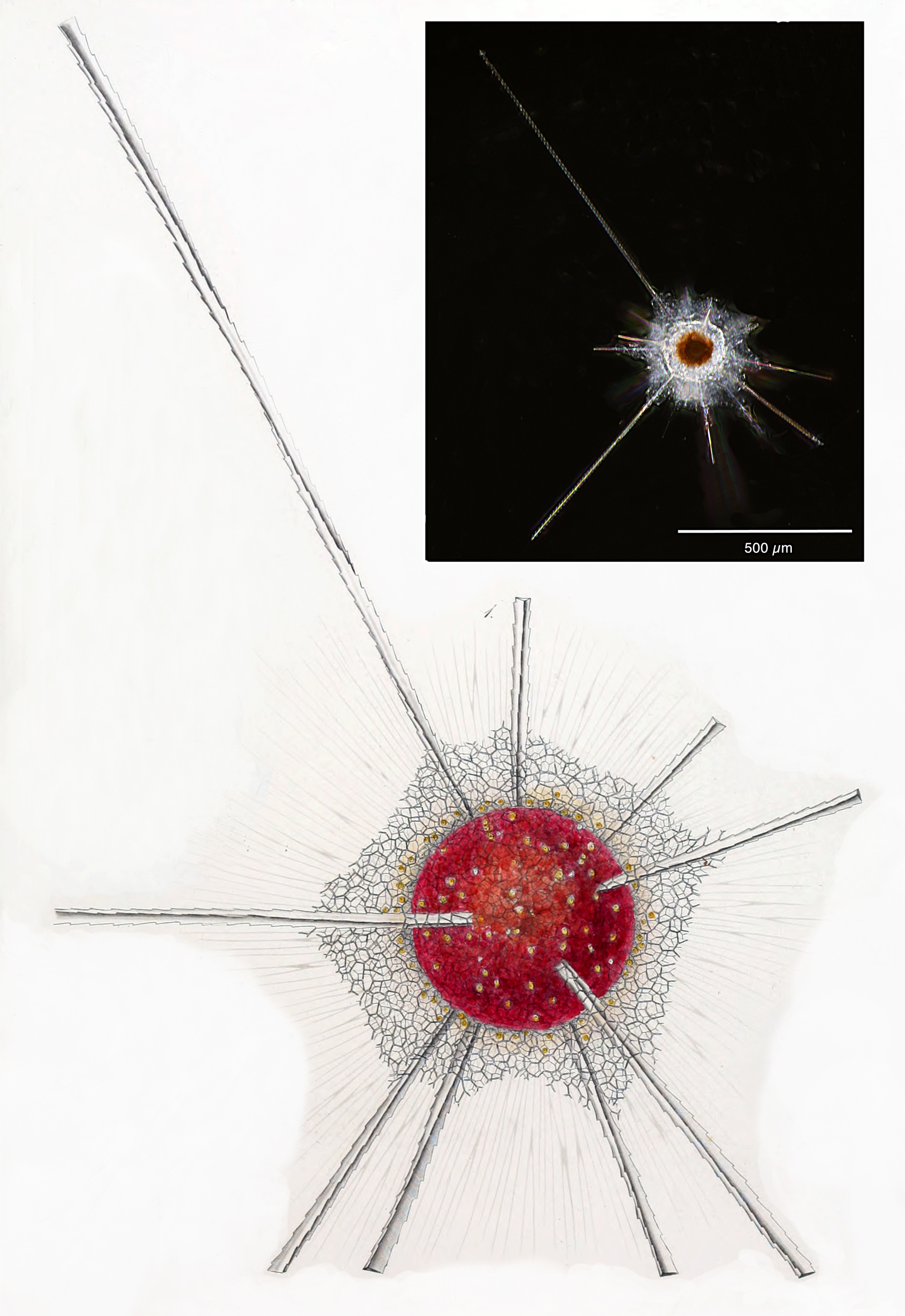Spongosphaera streptacantha (Haeckel 1861)