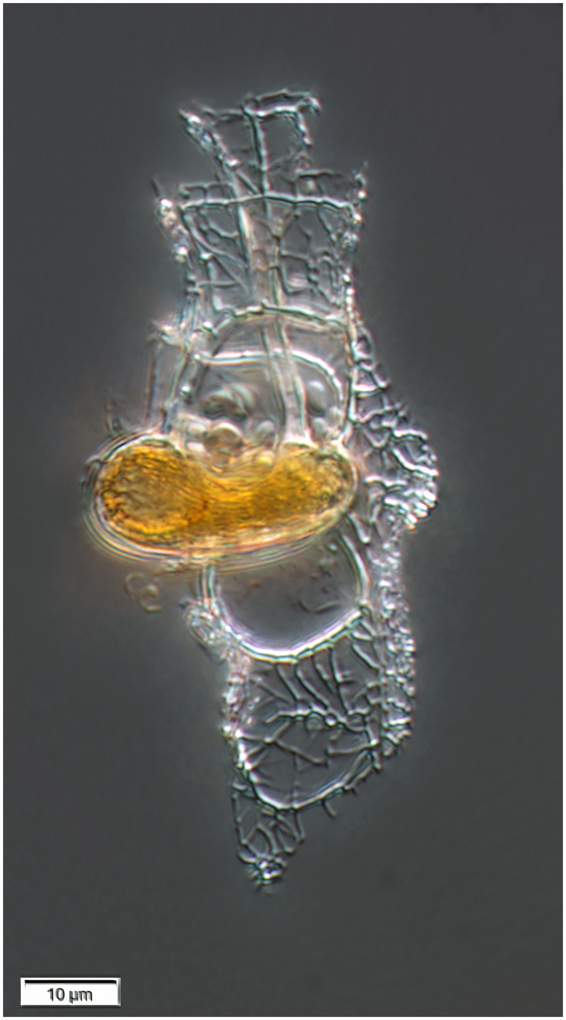 Histioneis mitchellana (Murray & Whitting 1899)