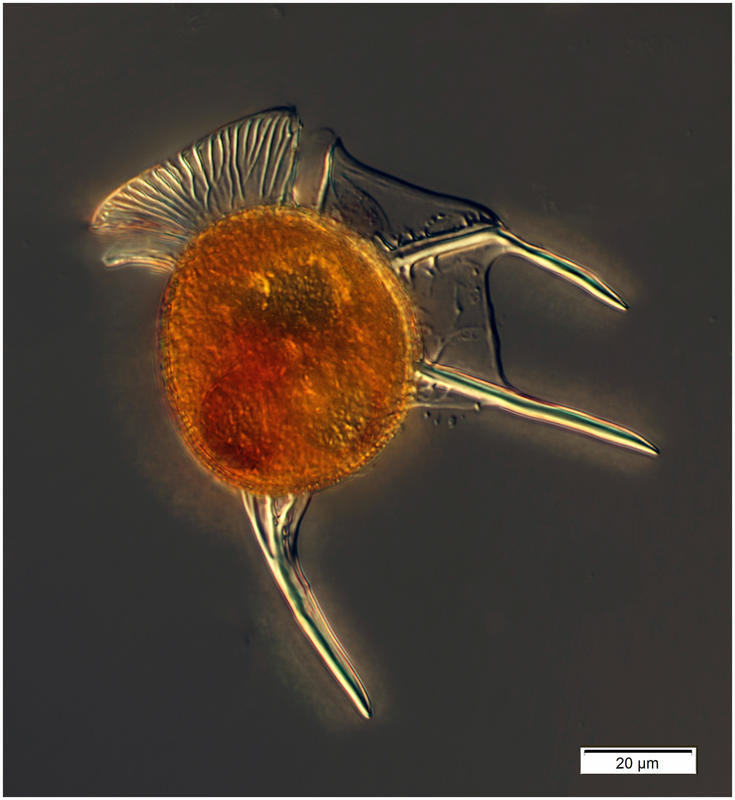 4Dinophysis schuettii