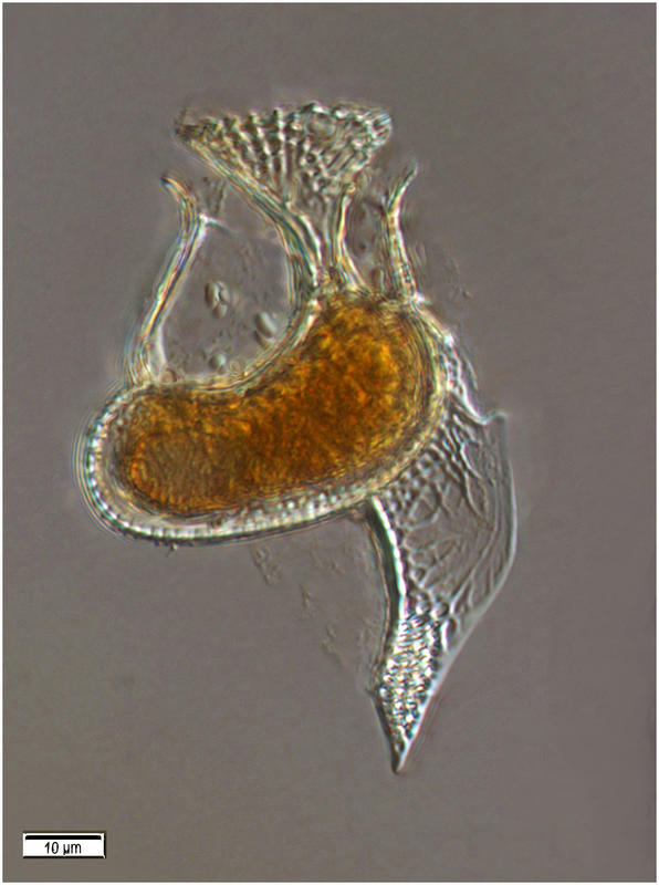 Histionesis carinata (Kofoid 1907)