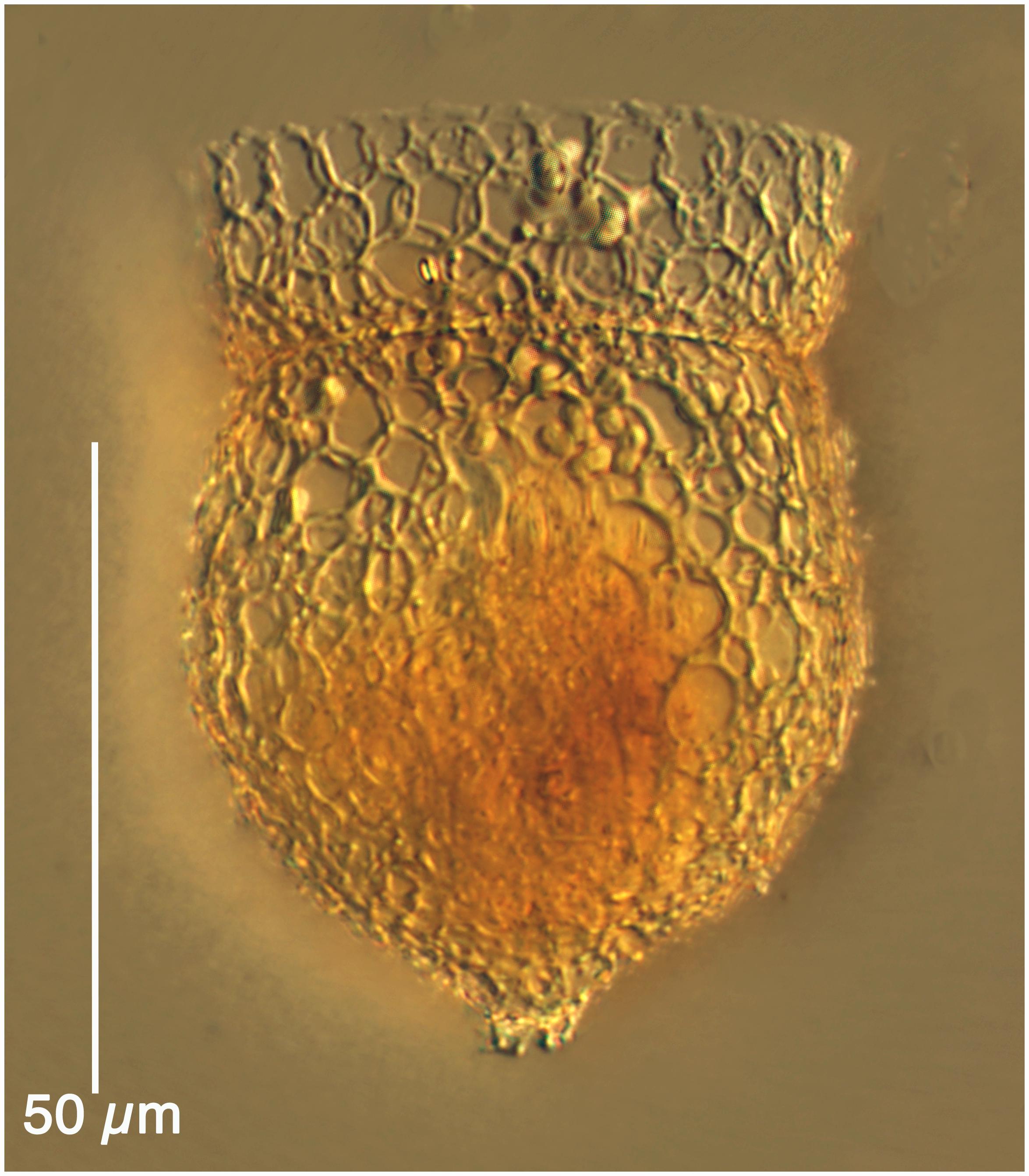 Codonella rapa, a tintinnid ciliate