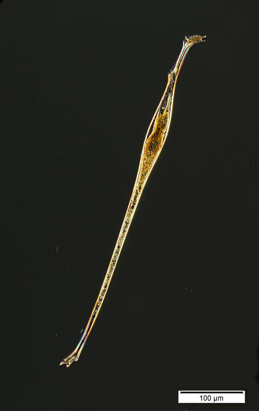 The dinoflagellate Amphisolenia bidentata