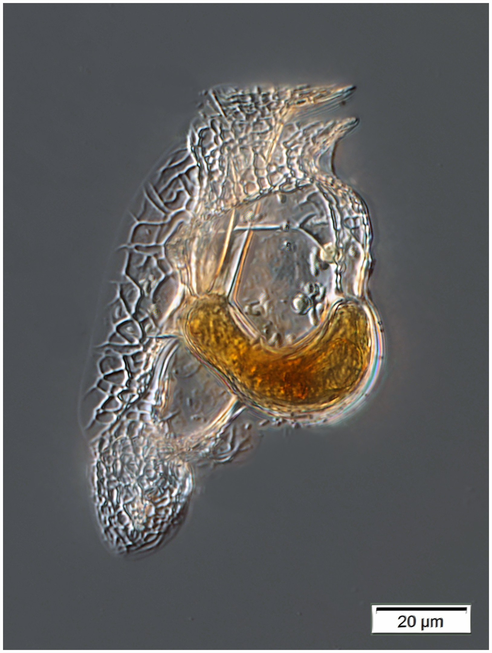 Histioneis mitchellana (Murray & Whitting 1899)