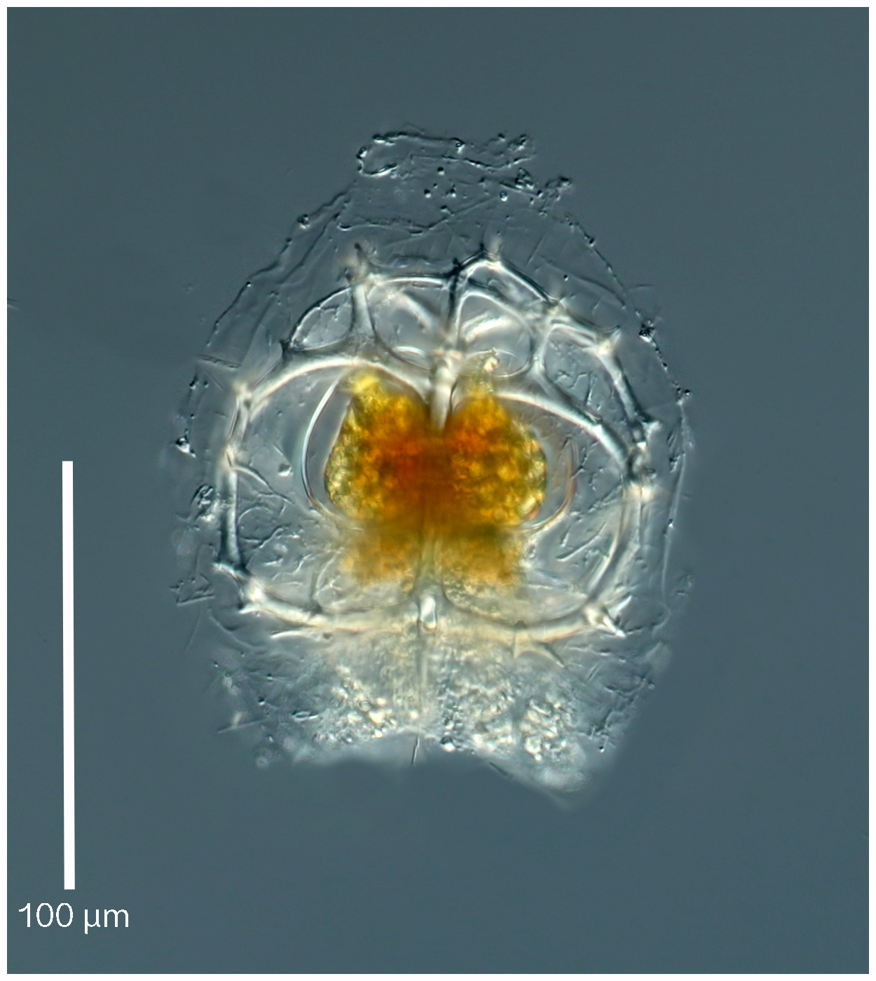 Ceratospyris borealis Bailey 1856