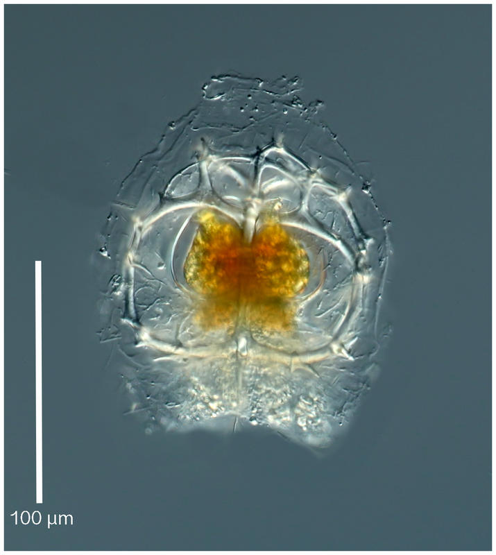 Ceratospyris borealis Bailey 1856