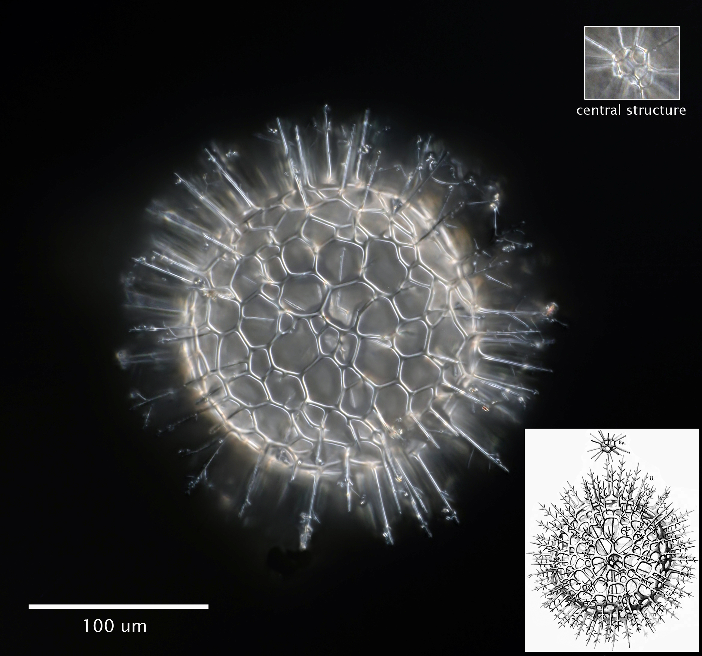 Elatomma juniperinum Haeckel 1867