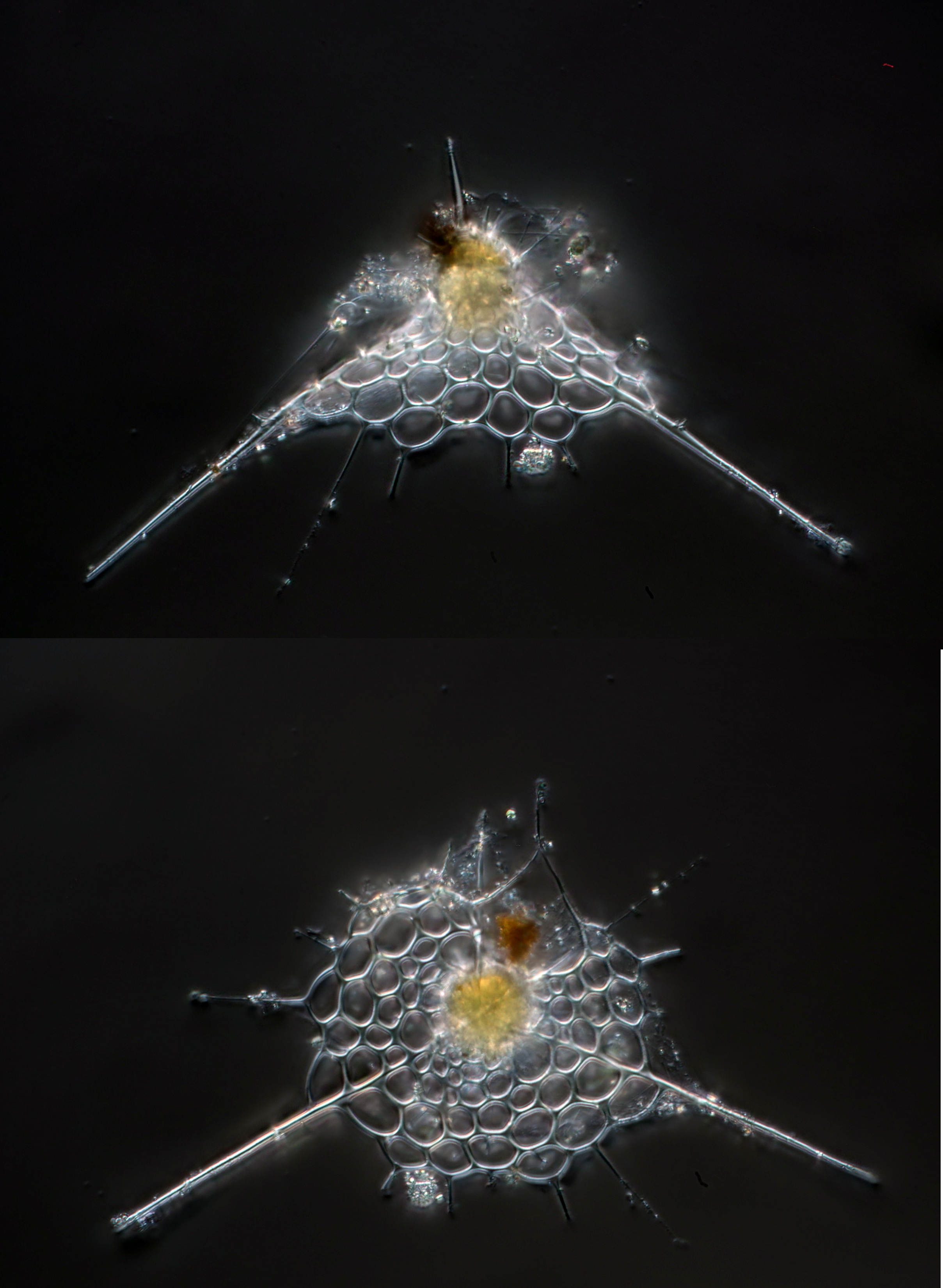 Tripodocyrtis platycephala (Haeckel, 1887)