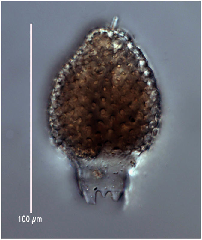 Carpocanium solitarium (Ehrenberg 1839)