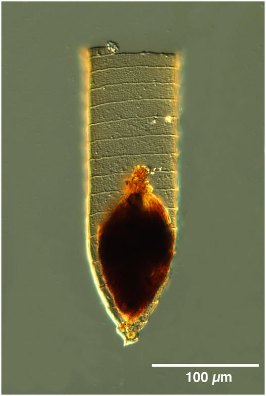 Favella ehrenbergii 'coxiella form'