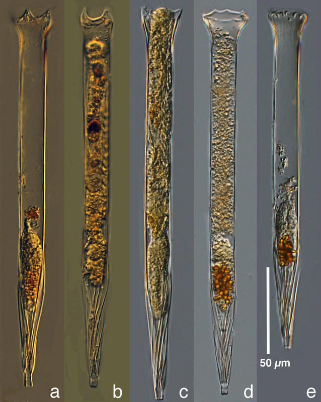 Varieties of Salpingacantha from a 2016 sample in the Chukchi Sea (2016 St 29).