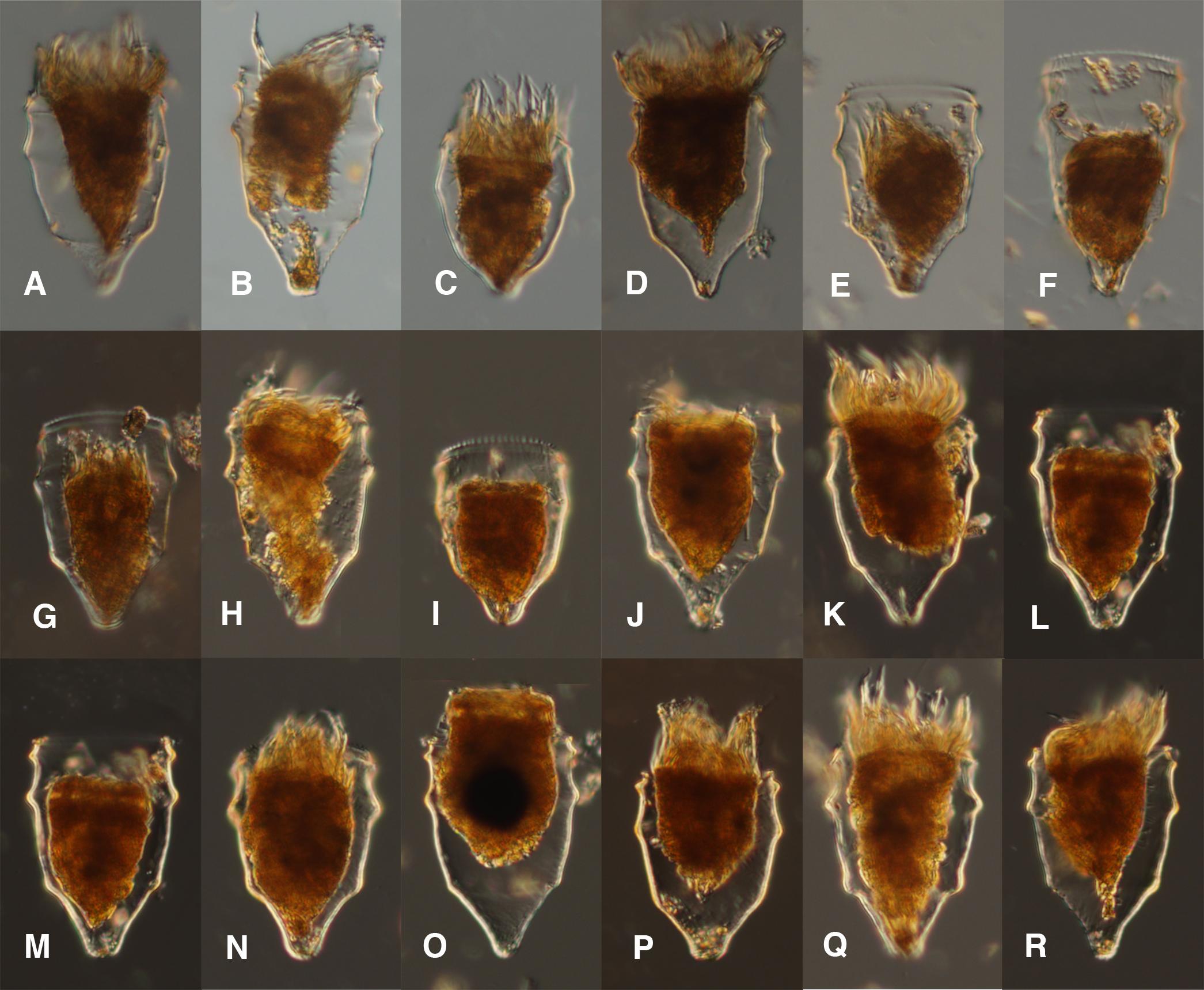 Morphological variability of Ptychocylis obtusa found in a single sample