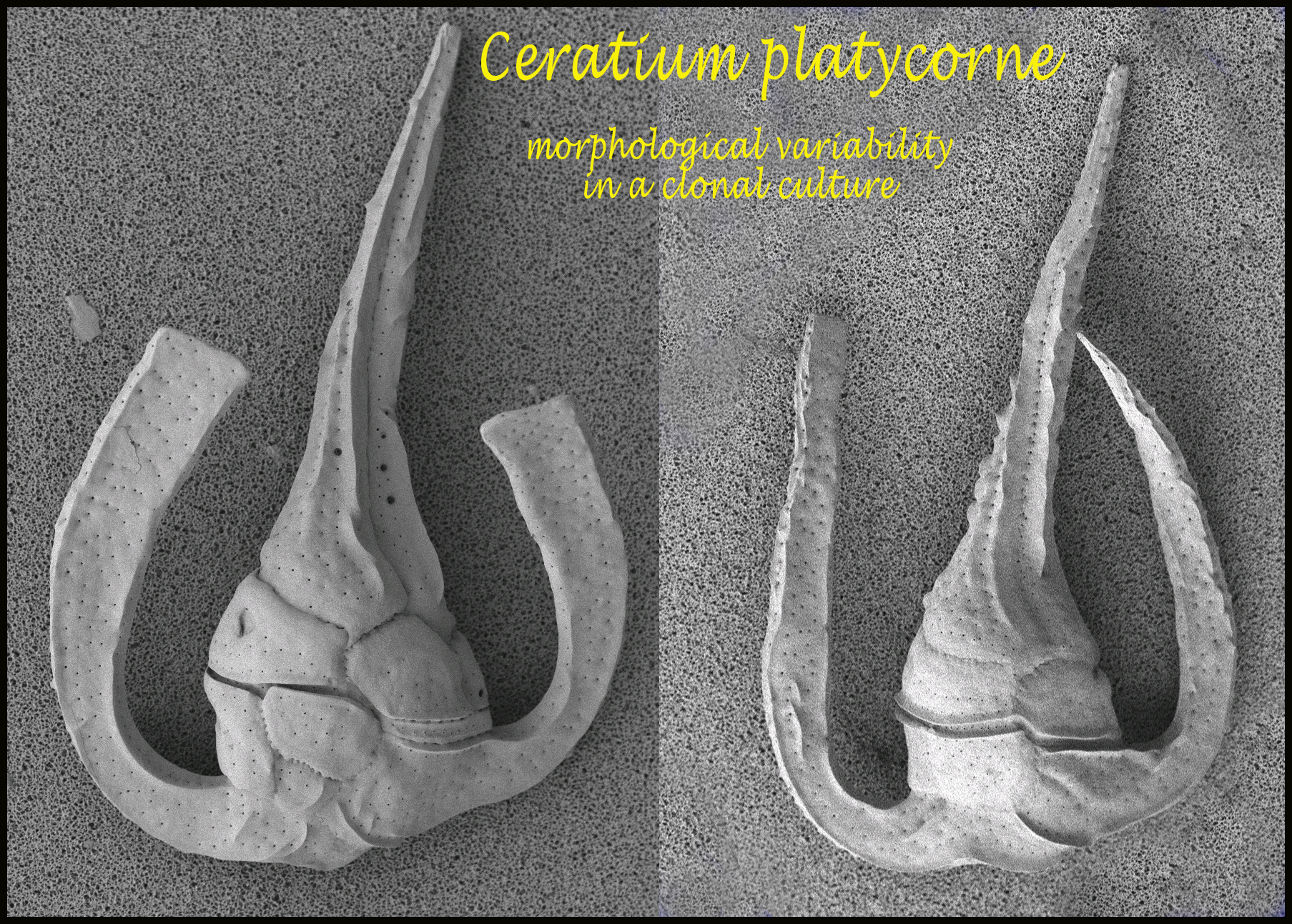 Ceratium platycorne SEM micrograph