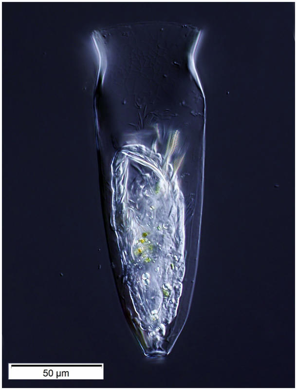 Tintinnid ciliate