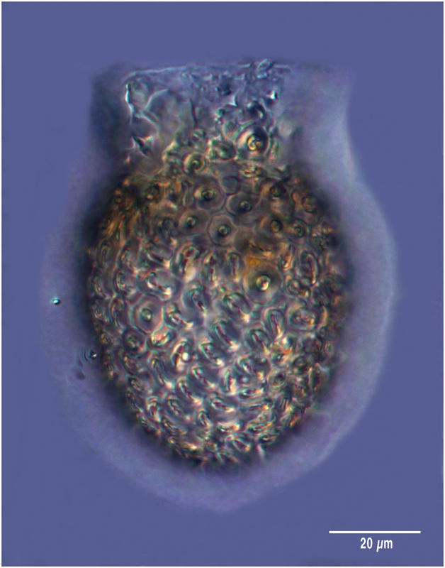 Tintinnid ciliate Codonella elongata