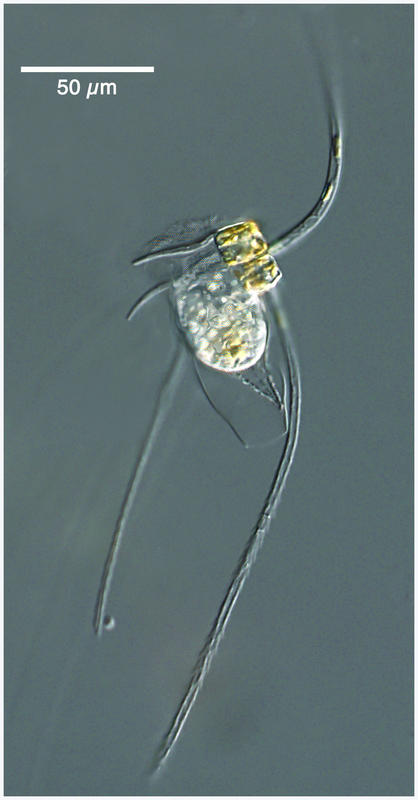 Tintinnid ciliate Eutintinnus apertus attached to a Chaetoceros