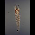 Tintinnid ciliate Daturella live from the deep