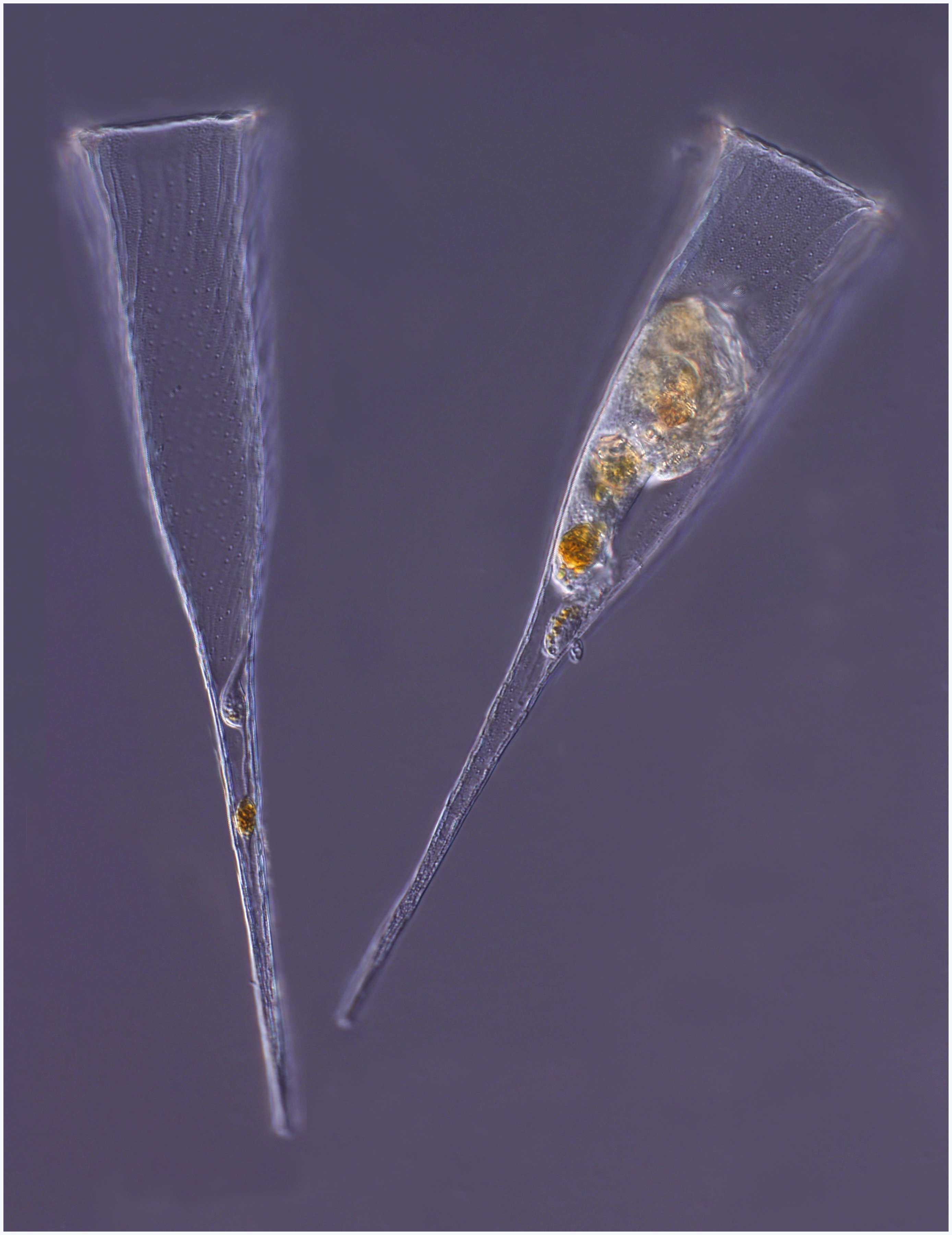Tintinnid ciliate Rhabdonella spiralis- lorica and live specimen