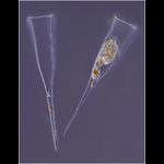 Tintinnid ciliate Rhabdonella spiralis- lorica and live specimen