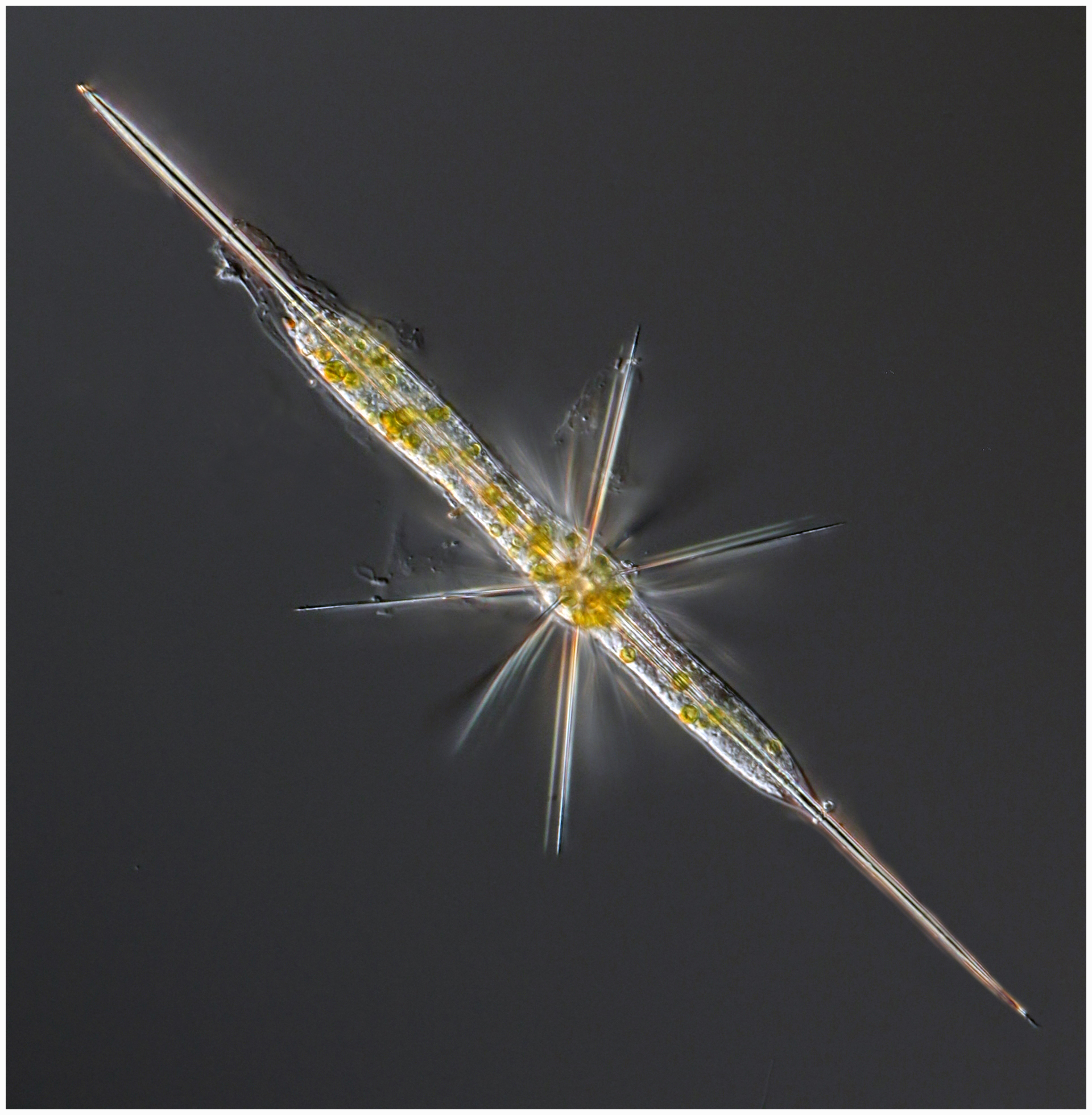 Acantharian Amphilonche elongata