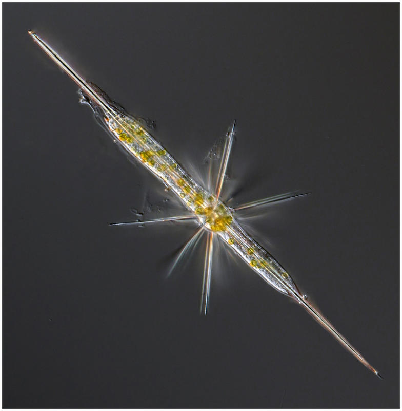 Acantharian Amphilonche elongata