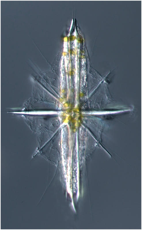 Acantharian Amphibelone mirum (Popofsky 1904)