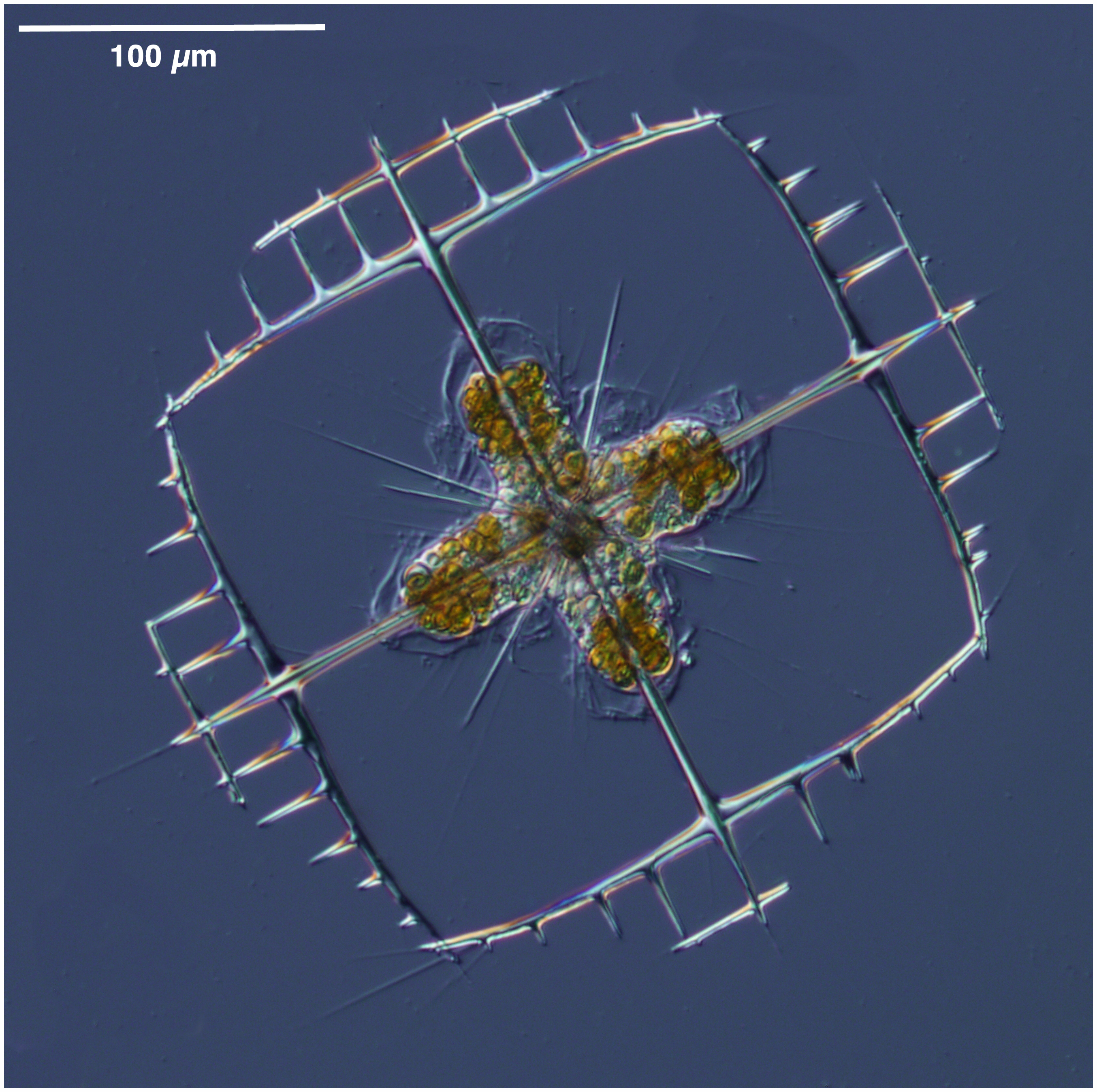 Acantharian Lithoptera fenestra