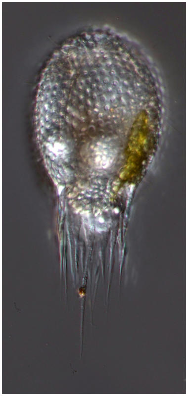 Radiolarian Carpocanistrum cephalum