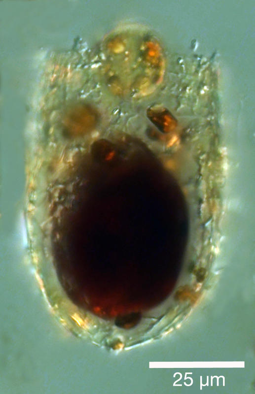 Metacylis sp 80LL 50LOD st1 ARA12B