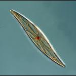 diatom