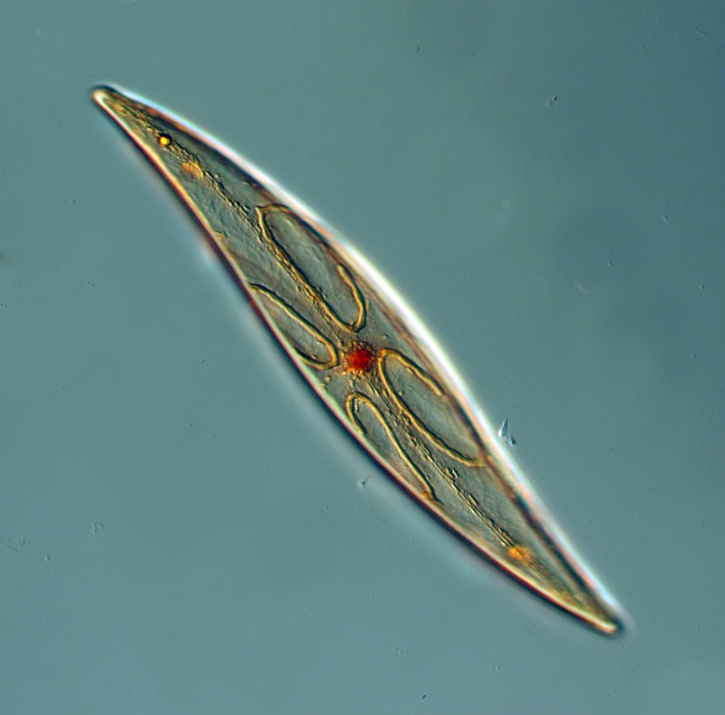 diatom