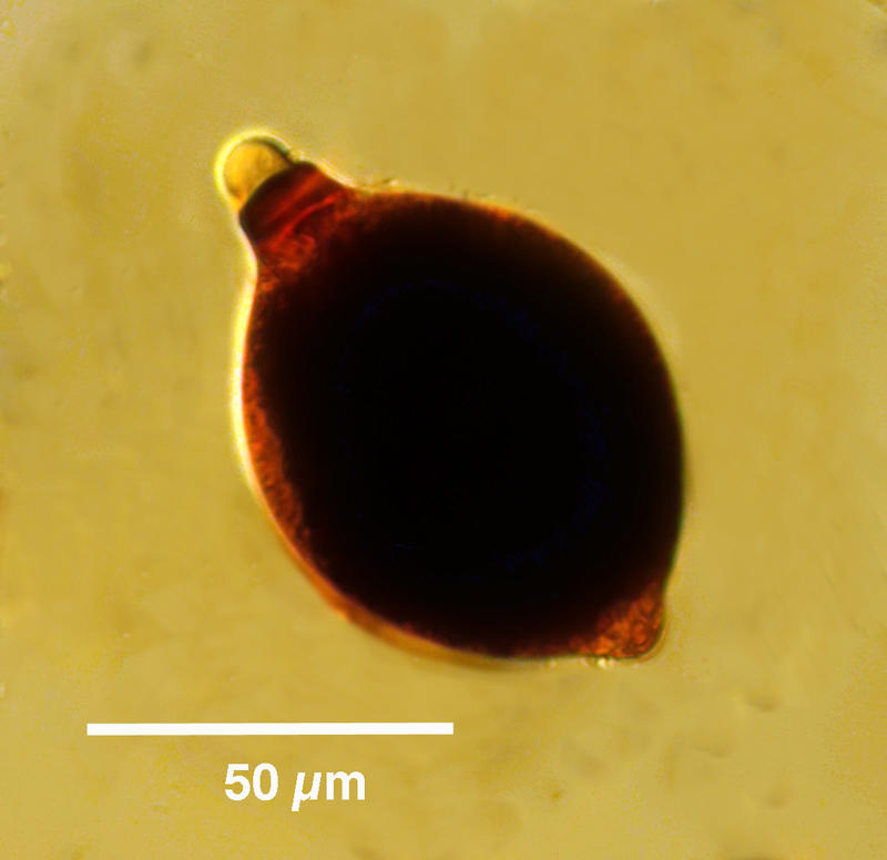 Presumptive Ciliate Cyst 'little ball'