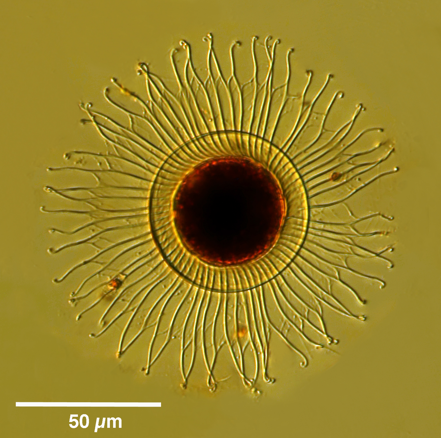 Ciliate Cyst 'wagon wheel'