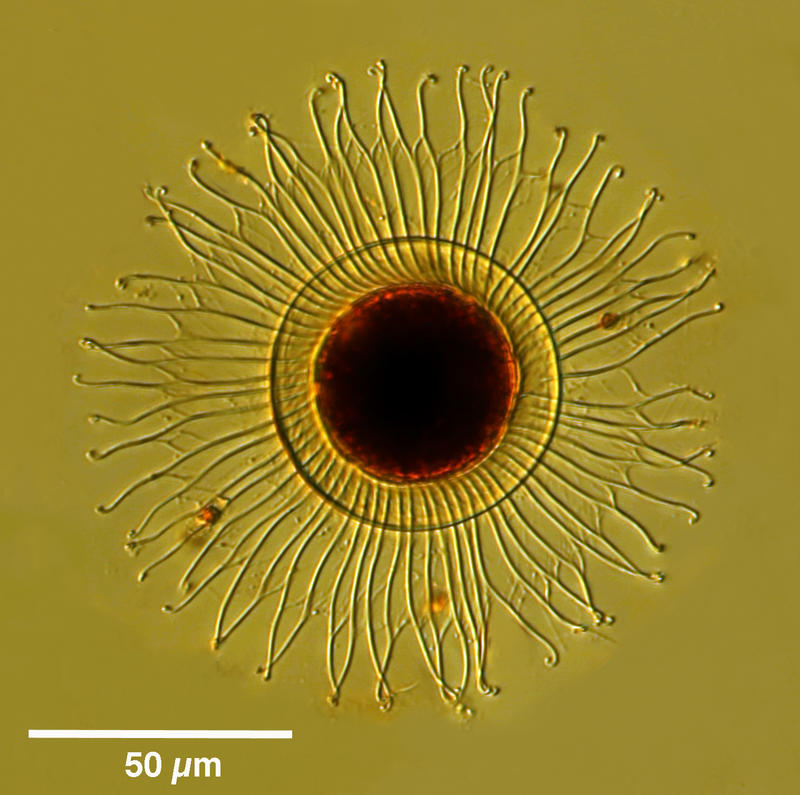 Ciliate Cyst 'wagon wheel'