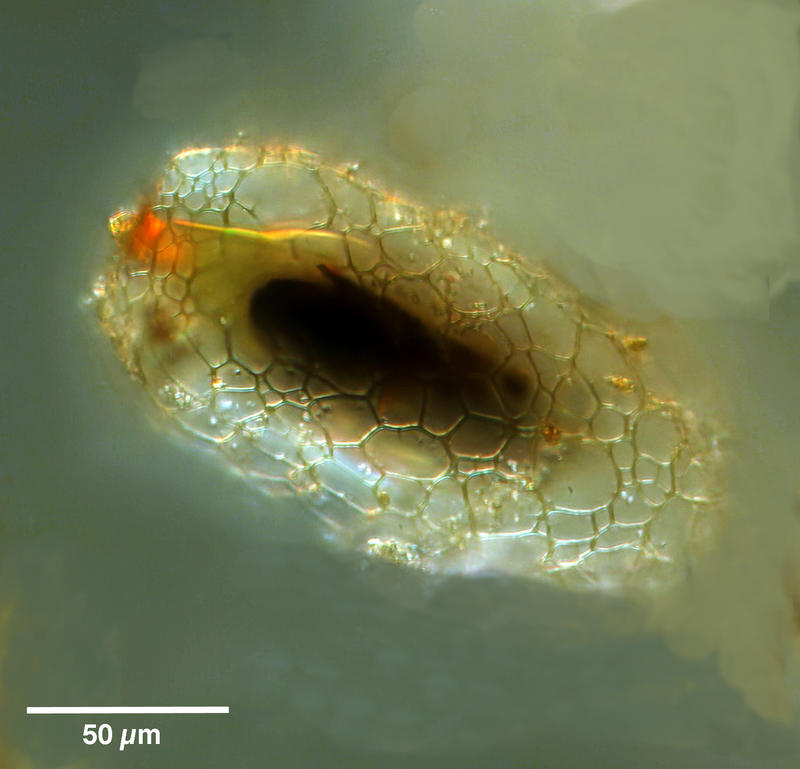 Presumptive Ciliate Cyst 'ship in a bottle'