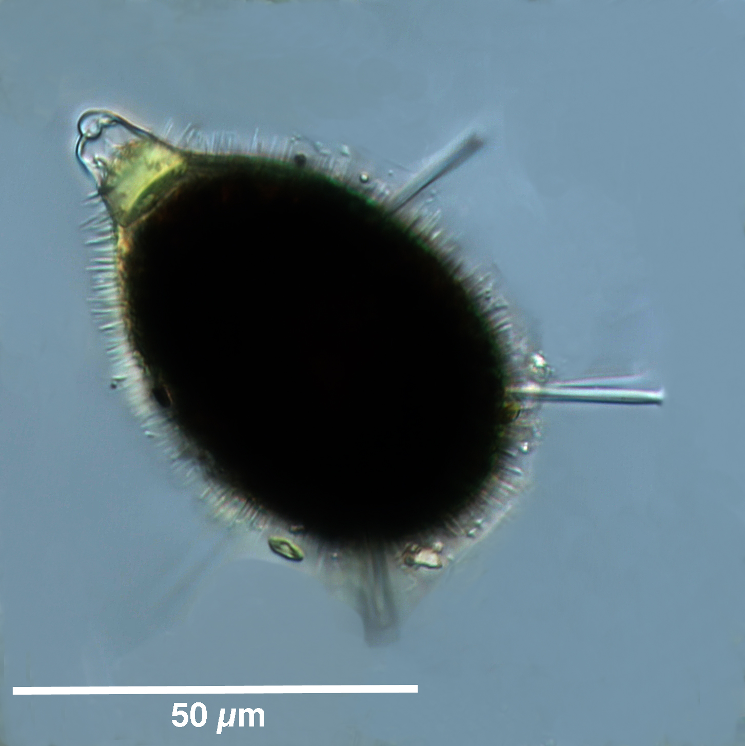 Ciliate Cyst 'prickly football'