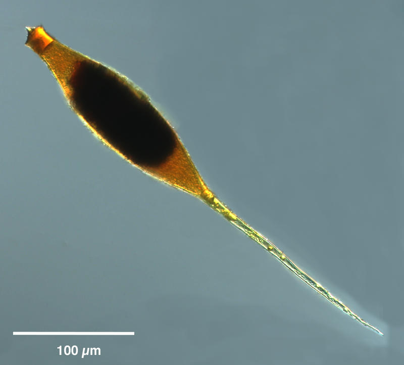 Ciliate Cyst 'fusopsis type'