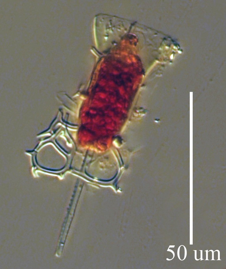 Cantheriella pyrimidata- Silicoflagellate/Diatom Collector May9 PtC