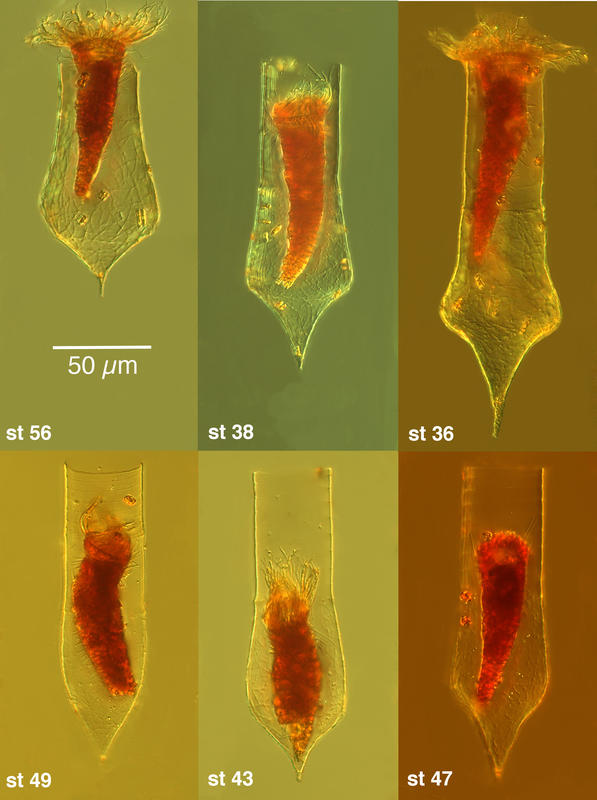 Codonellopsis gaussi