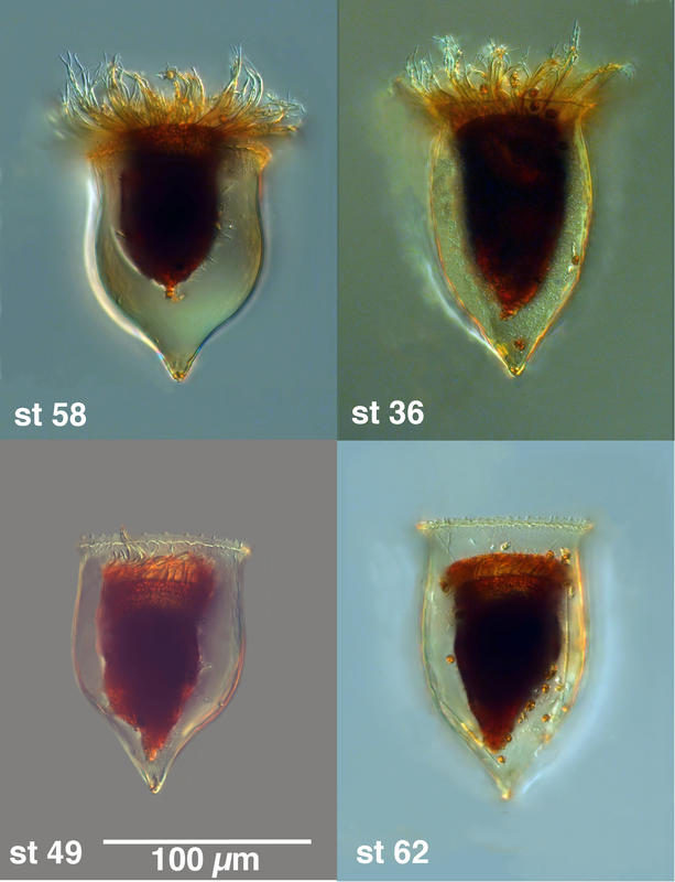 Cymatocylis convallaria