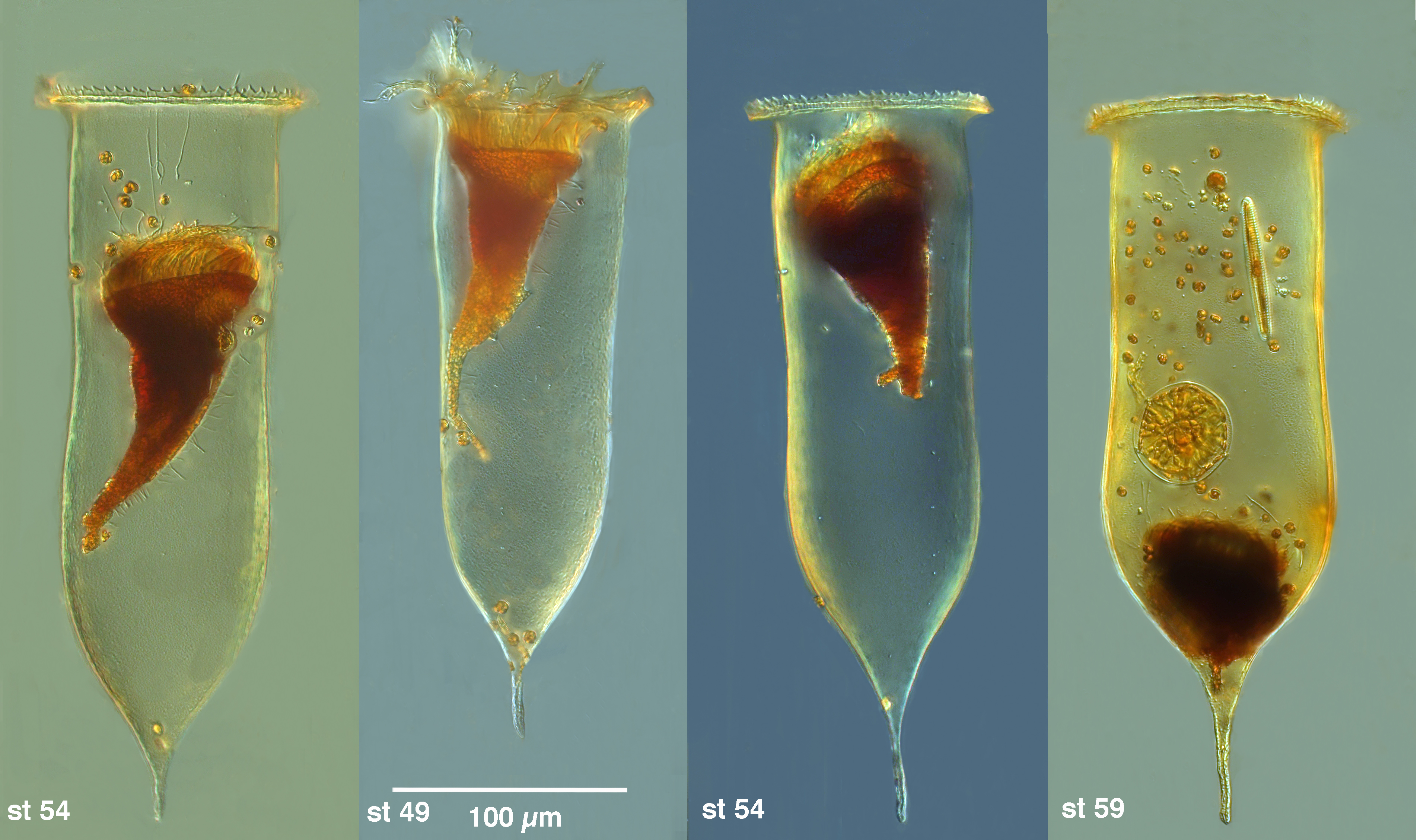 Cymatocylis drygalaski