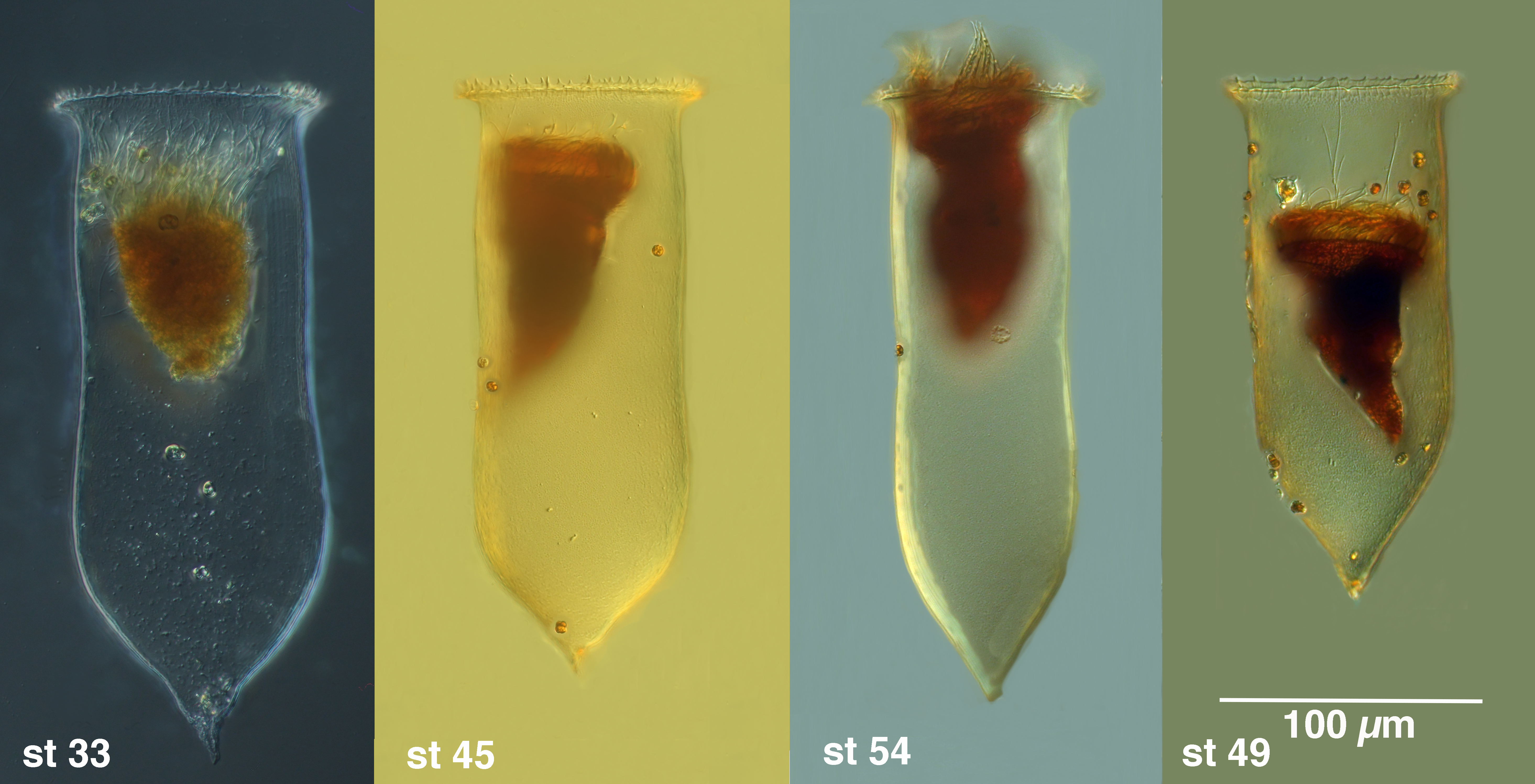 Cymatocylis eucaudata