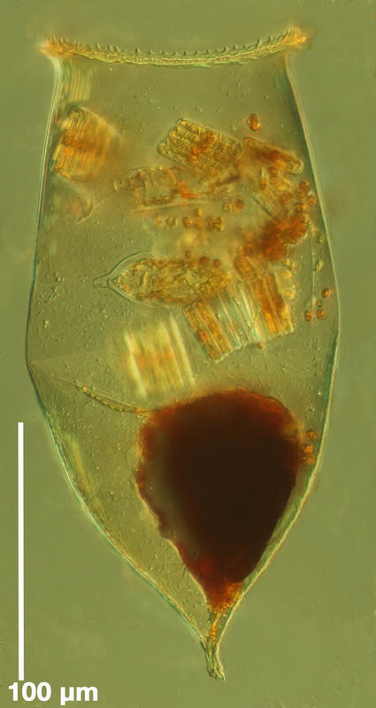 Cymatocylis ovata