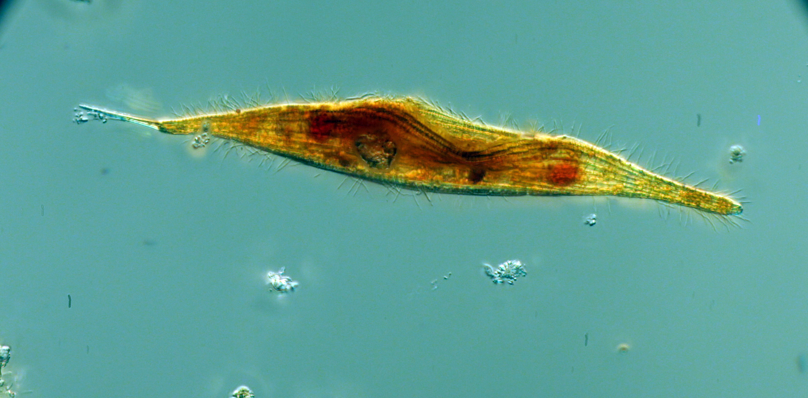 Unicorn ciliate